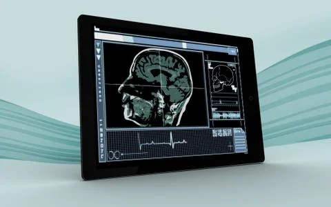 Digital tablet showing brain interface 库存照片