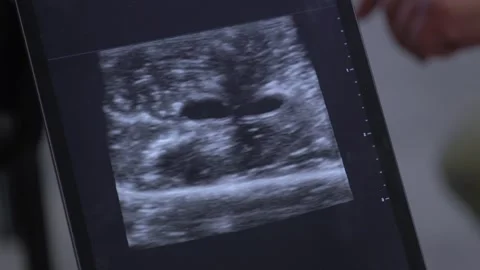 Digital ultrasound diagnostics using tablet in modern healthcare 스톡 동영상 328528117