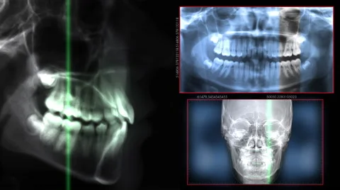 Digital x-ray dental scan technology Vidéo 68638080