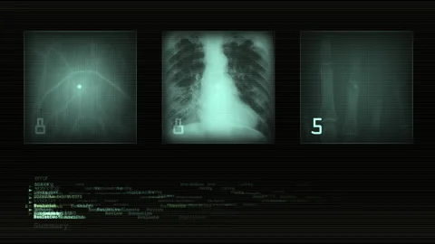 Digital X Ray Images Computer Interface Data Code Stream Stock Footage 293781462