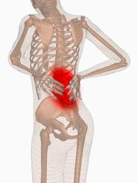 Digitally generated image of human representation feeling pain Stock Illustration