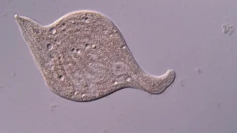 Dileptus Ciliate 库存影片 310642401