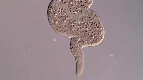 Dileptus Ciliate under microscope 库存影片 310645593