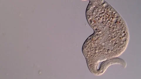 Dileptus Ciliate under microscope 库存影片 310645644