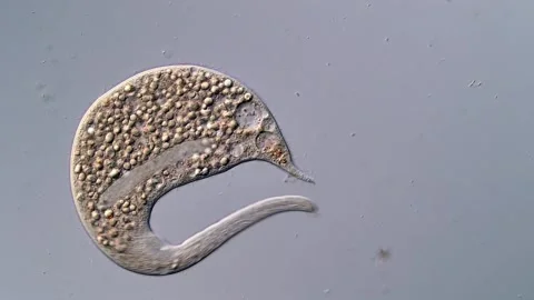 Dileptus Ciliate under microscope view 400x 스톡 동영상 310386824