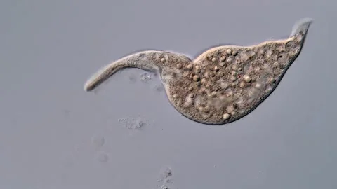 Dileptus ciliophora under microscope view 400x magnification 스톡 동영상 310377223