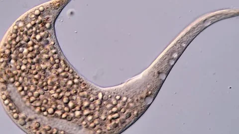 Dileptus ciliophora under microscopy view Vídeos de archivo 310377359