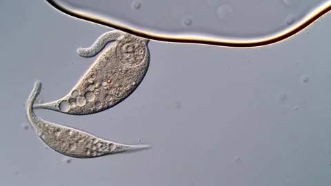 Dileptus ciliophora under microscopy view Vídeos de archivo 310490962