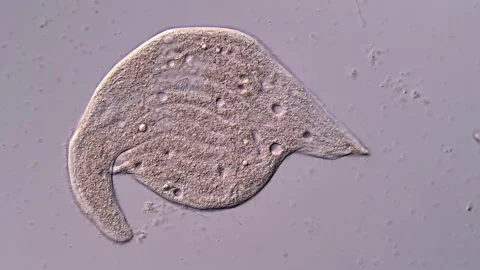 Dileptus ciliophora under microscopy view 库存影片 310642377