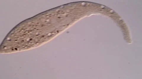 Dileptus ciliophora under microscopy view 库存影片 310644872