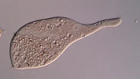 Dileptus ciliophora under microscopy view 库存影片 310645159