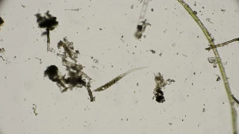 Dileptus in search of food under a microscope Stock Footage 92179979