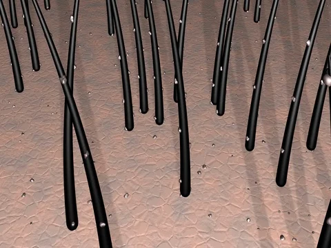 Dirt particles, dandruff, debris on Both hair and scalp, skin Stock Footage 76085843