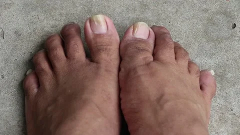 Dirty foot on ground Stock Footage 159596037