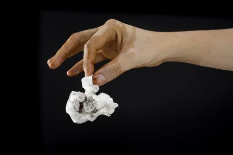 Dirty hand with germs Stock Photos