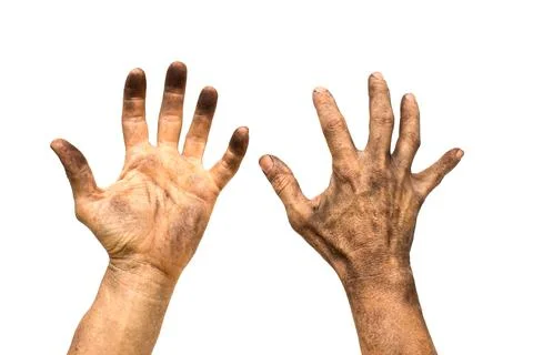 Dirty Hand Stock Photos