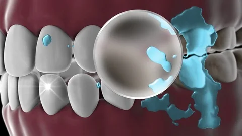 Dirty Teeth Full of Germs get Cleaned by Toothpaste and Water Version 1 Vídeo Stock 73357531