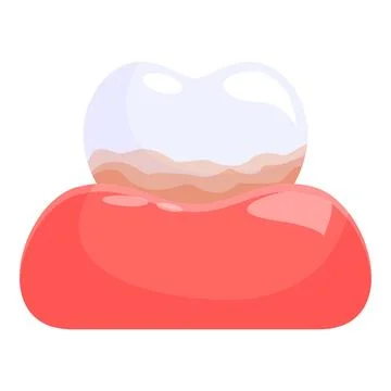 Dirty tooth showing gingivitis and needs urgent cleaning from dentist Stock Illustration