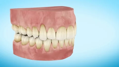 Dirty Yellow Teeth Turning Close Up 3d Animation. Stock Footage 80231244