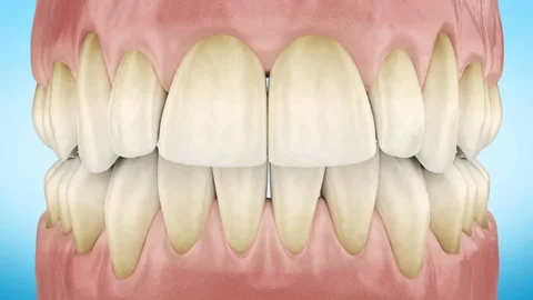 Dirty Yellow Teeth Zoom Close Up 3d Animation. Stock Footage 80255584