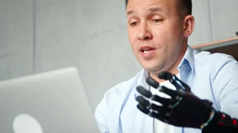 Disabled guy explains moving bio hand prothesis talking Stock Footage 157331259
