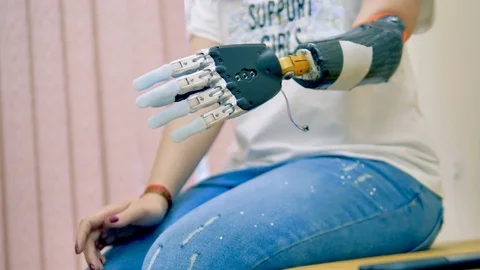 A disabled patient using robot-assisted bionic arm. Stock Footage 82291385