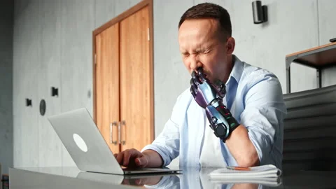 Disabled programmer with bio hand prothesis solves problem Stock-Footage 157347916