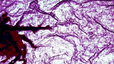 Disease Affects the Body 4K 2TZ Stock Footage 315472970
