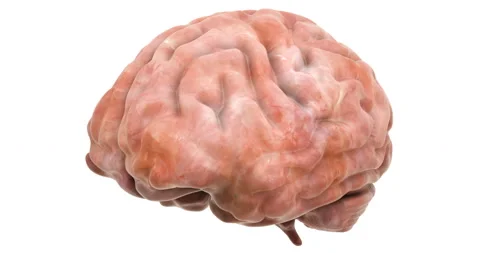 Disease spread on brain, 3d animation. 3D rendering isolated on white backgro Stock Footage 100184115