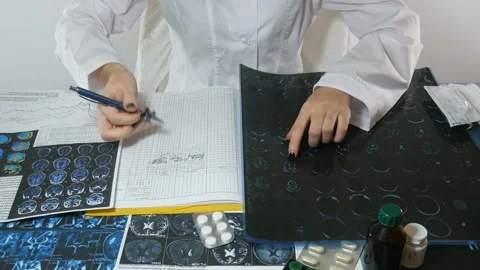 Diseases of the brain Stock-Footage 87478637