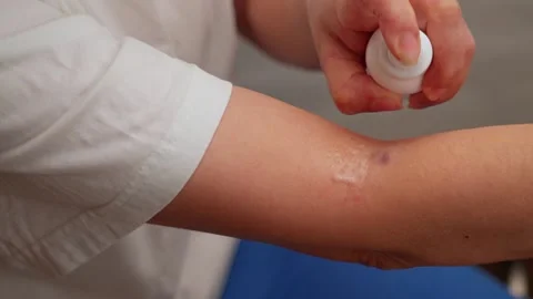 Disinfecting the wound Stock Footage 321945808