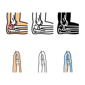 Dislocated joint fracture range color icon vector Stock Illustration