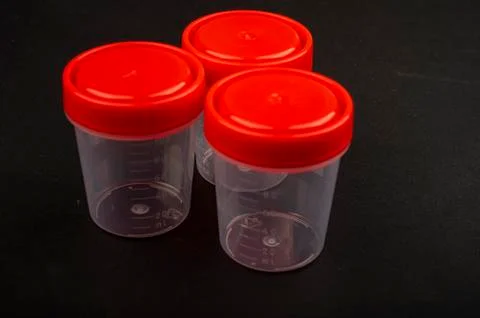 Disposable containers for collecting material for analysis. Close up. Stock Photos
