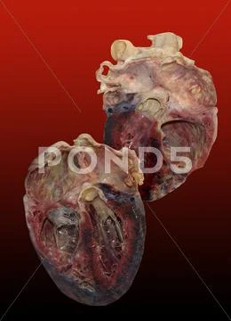 Dissected human heart Stock Illustration