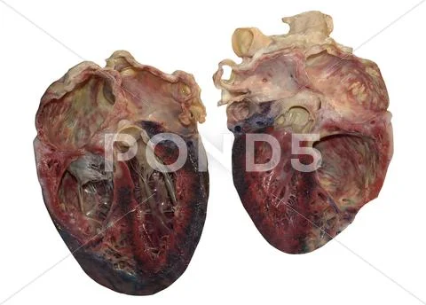 Dissected human heart Stock Illustration