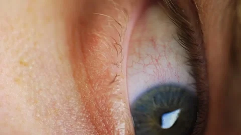 Distressed Blue Eye Close Up. Vertical Video Stock Footage 130947851