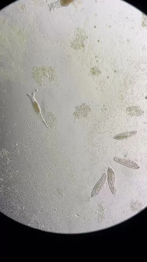 Diverse Microorganisms and Protozoa Under Microscope in Laboratory China Stock Footage 339649724