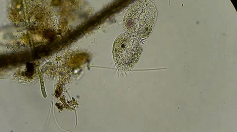 Dividing cell of infusoria under microscope Stock-Footage 33661615