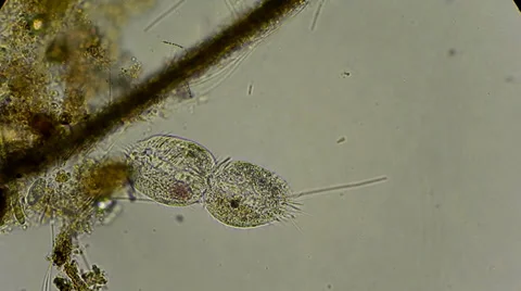 Dividing infusoria under microscope Stockbeeldmateriaal 33661705