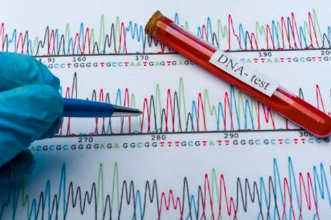 DNA molecule forming inside the vial in for blood analysis.3D rendering, conc Stock Photos