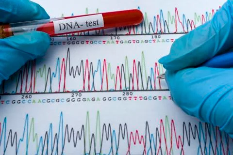 DNA molecule forming inside the vial in for blood analysis.3D rendering, conc Stock Photos