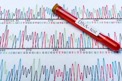 DNA molecule forming inside the vial in for blood analysis.3D rendering, conc Stock Photos