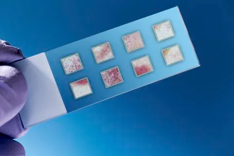 Dna samples on a microscopy slide Foto stock
