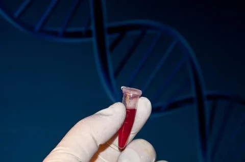 DNA testing of the blood. Stock Photos