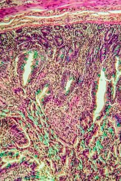 Dnndarm Stock Photos