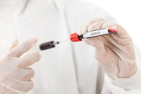 Doc working with covid virus test tube Stock Photos