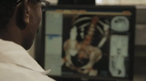 Docter looking at Xray modle Stock Footage 30206458