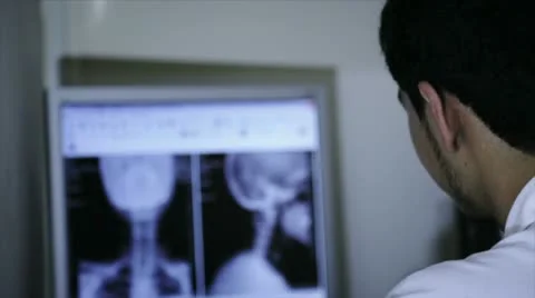 Doctor analize x ray at computer Stock-Footage 12459052