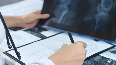 Doctor analyzes the x-ray of bones in the hospital Stock Footage 86690147