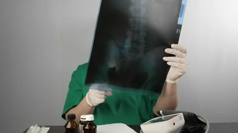The doctor analyzes the x-ray Video stock 239916201